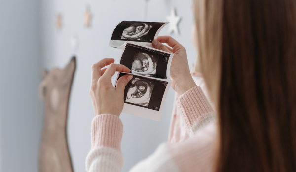 Fertility Myths and Facts: Dispelling Common Misconceptions About Conception