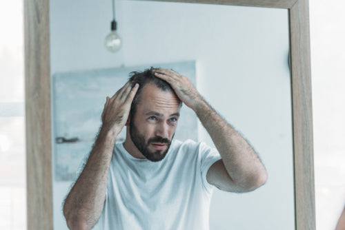 Does Stress Really Cause Hair Loss?